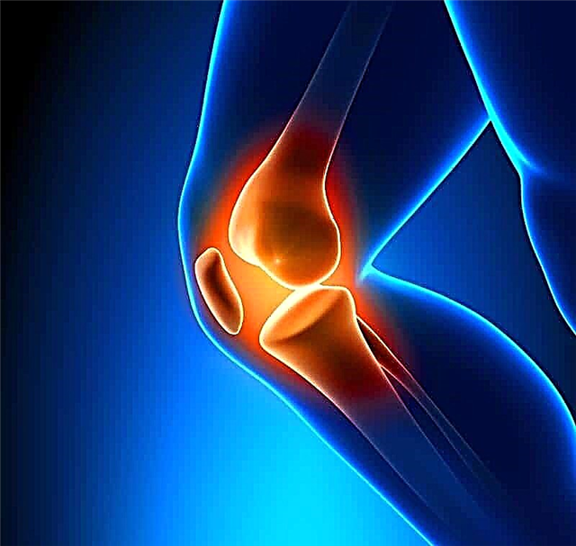 Фрактура на коленото: клинички симптоми, механизам на повреда и третман