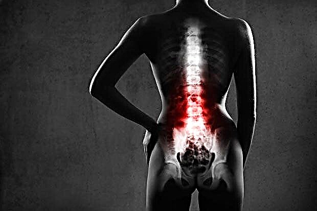 Spinal (spinal) skade - symptomer, behandling, prognose