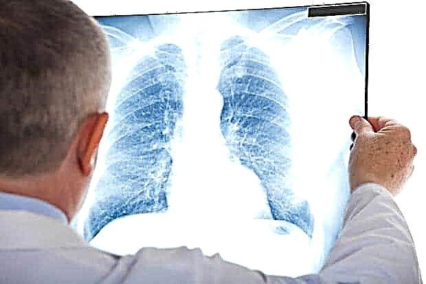 Penyakit paru-paru - gejala klinikal dan pemulihan