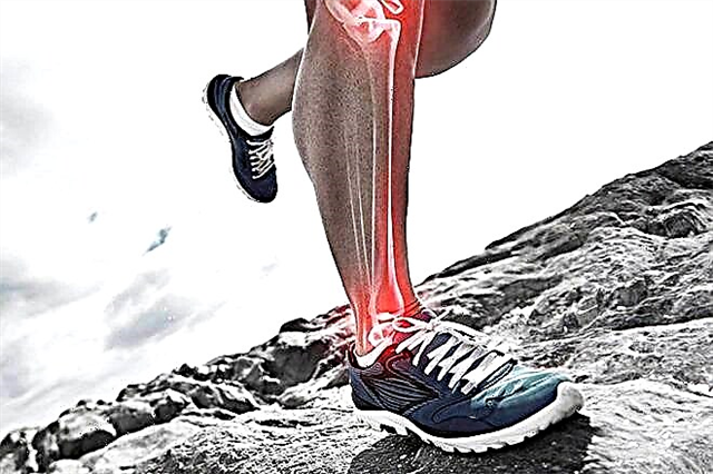 Alt bacağın periostunda bir iltihaplanma olduğunda, patoloji nasıl tedavi edilir?