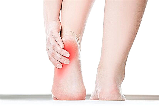 Đau gót chân sau khi chạy - nguyên nhân và cách điều trị